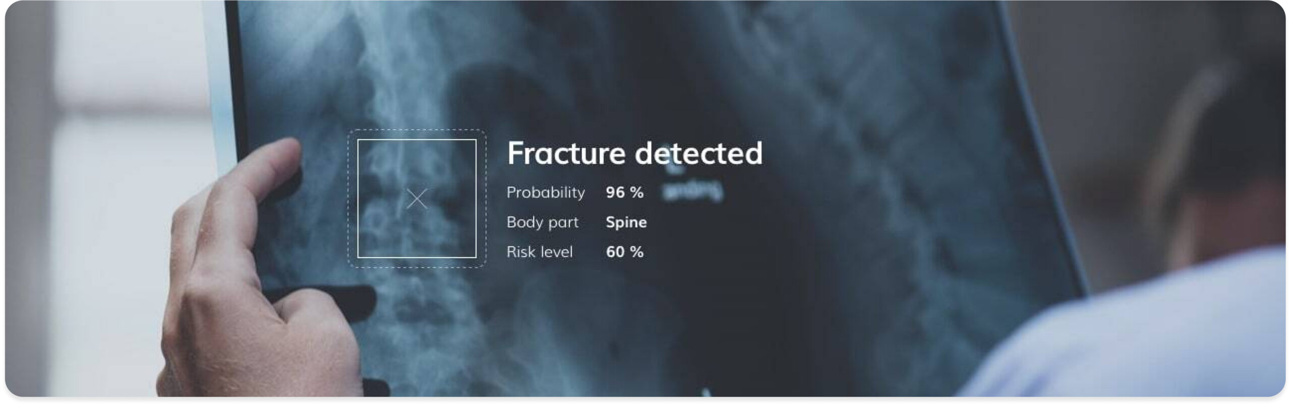 Leverage your biomedical expertise with Ximilar's AI. From microbiology samples to X-rays and skin lesions, machine learning helps capture expert knowledge, automate processes, support lab workers, develop new applications, and improve patient care.