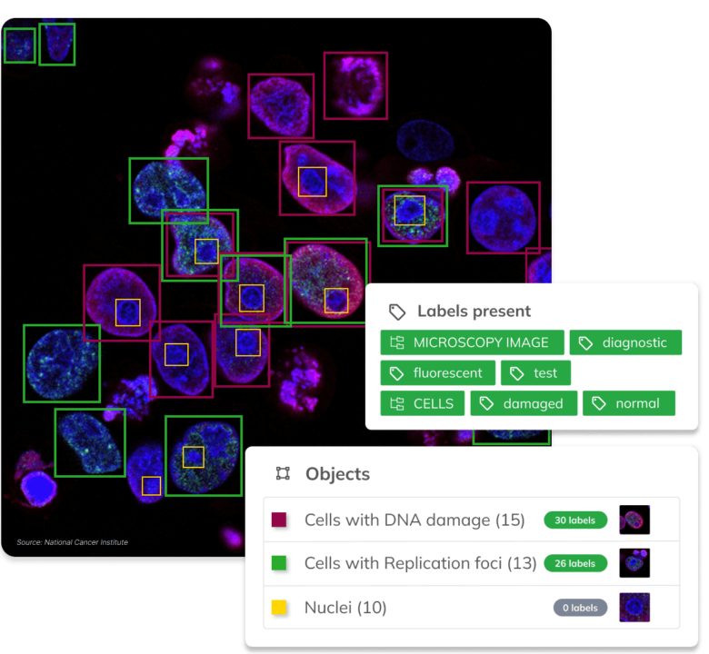 Visual AI by Ximilar can be customized with specific categories, objects, attributes, labels, whole taxonomies or even languages to fit specific use cases. In this case, object detection and image recognition are combined to spot and identify objects in a fluorescent microscopy image.