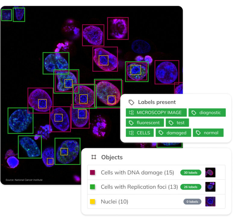 Visual AI by Ximilar can be customized with specific categories, objects, attributes, labels, whole taxonomies or even languages to fit specific use cases. In this case, object detection and image recognition are combined to spot and identify objects in a fluorescent microscopy image.